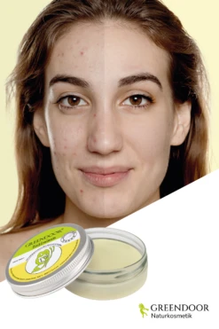 Zinkbalsam 9 Zinkbalsam -Hautpflegeprodukte MAM 8424976 SHOP IMAGE 1.4